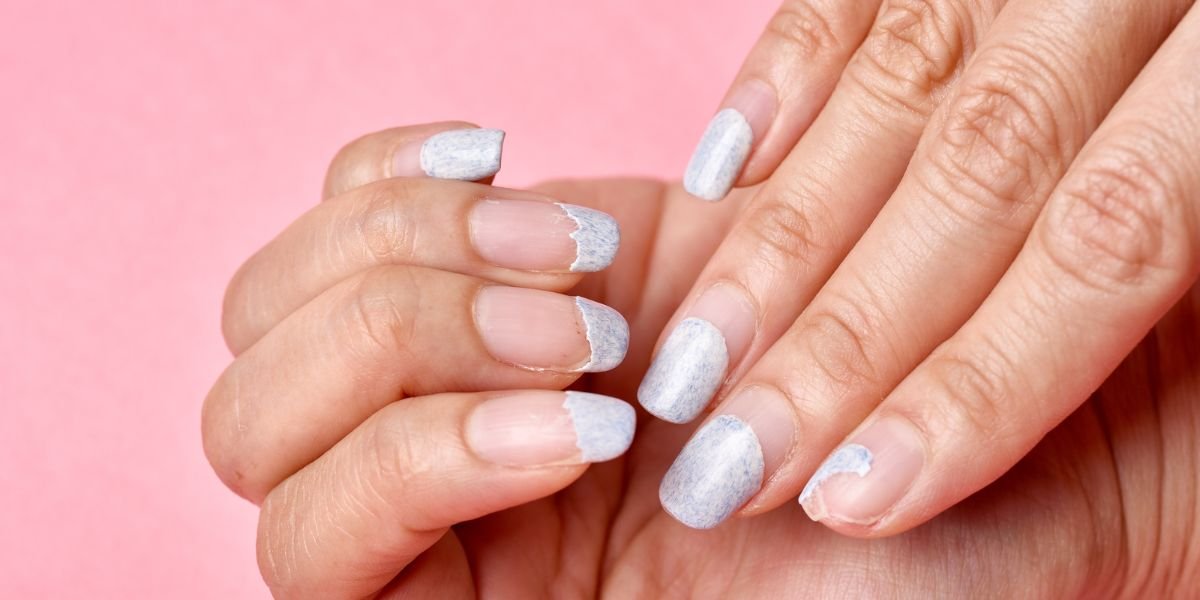 What Are the Signs of Nail Damage and How Can You Fix Them?